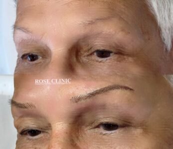 best cosmetic tattoo clinic in perth - rose clinic