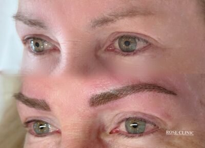 Best eyeliner clinic in perth